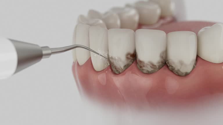 Trusted Root Canal Treatment service in Clifton, NJ - Dentist Open Now
